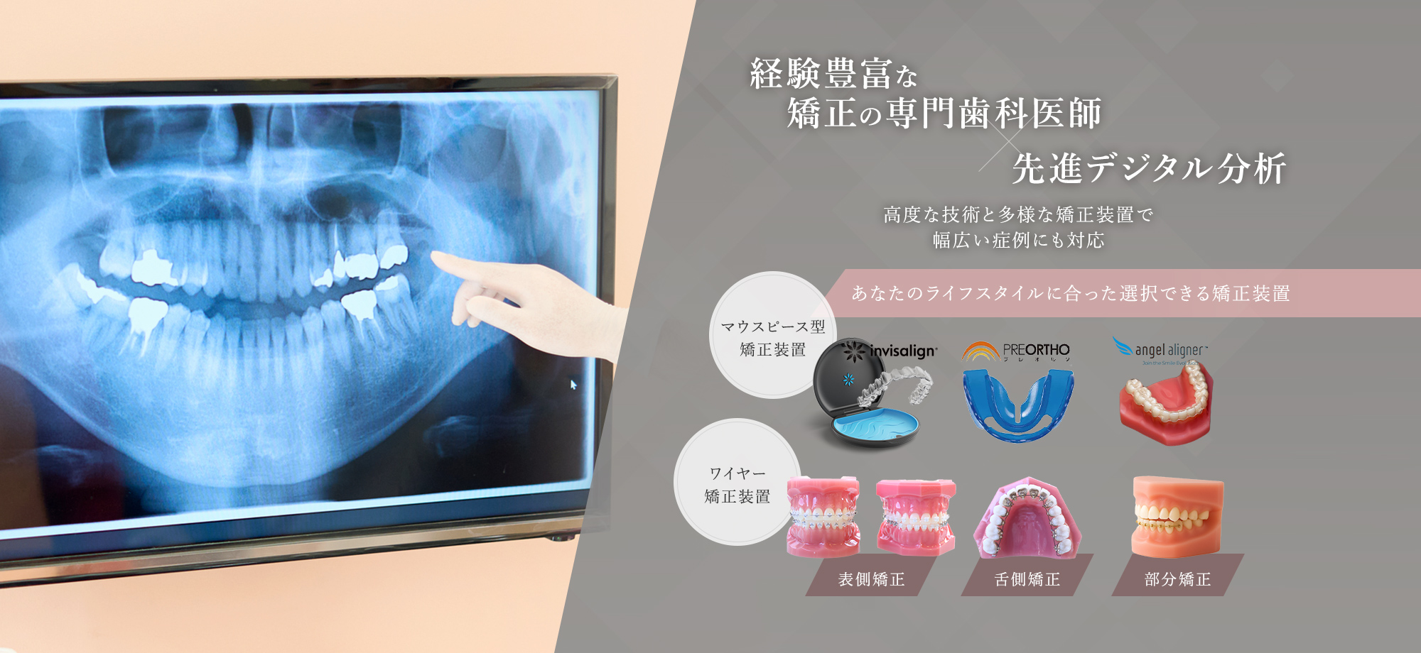 経験豊富な矯正の専門歯科医師 先進デジタル分析 高度な技術と多様な矯正装置で幅広い症例にも対応 あなたのライフスタイルに合った選択できる矯正装置 マウスピース型矯正装置 ワイヤー矯正装置
