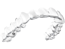 取り外し可能で口腔内を清潔に保てる痛みの少ない目立たないカスタムメイド型マウスピース矯正