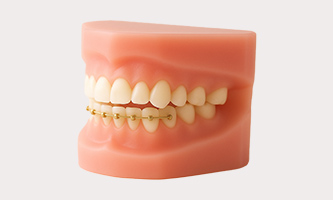 ハーフリンガル