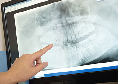 御器所矯正歯科