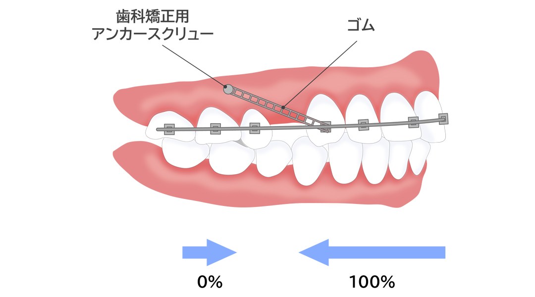 治療期間と通院頻度について