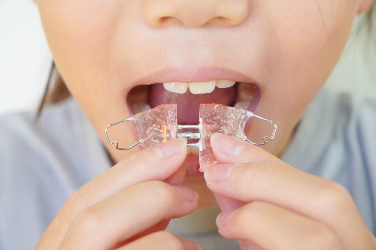 成長を活かす拡大装置・機能性矯正装置について