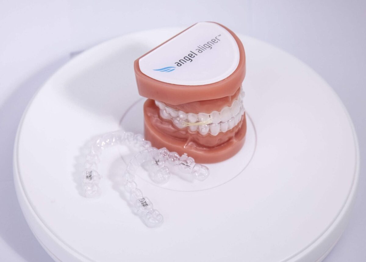 エンジェルアライナー 🄬