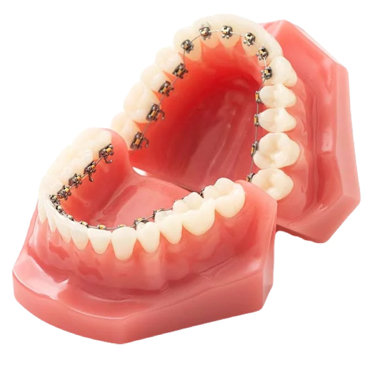 見えない矯正を実現する「舌側矯正(裏側矯正)」